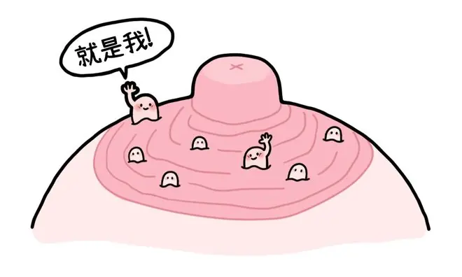乳晕上的小颗粒，到底是啥啊？