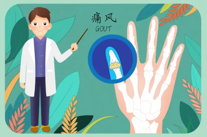 科普时间丨尿酸高但关节不痛，就不用管吗？