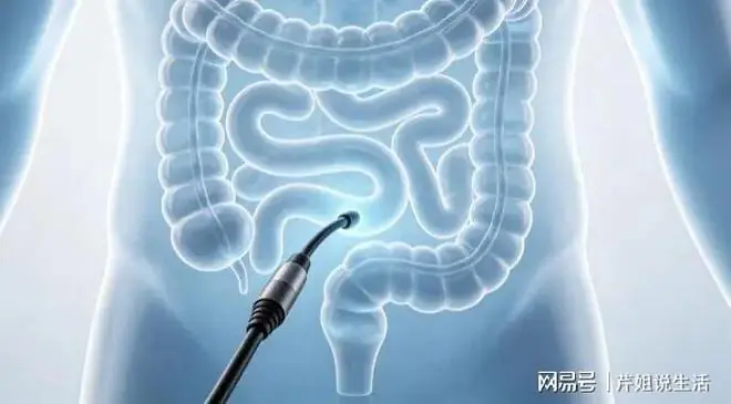 非必要不做肠镜?医生:只要做过肠镜,患者一定多加关注这4点!