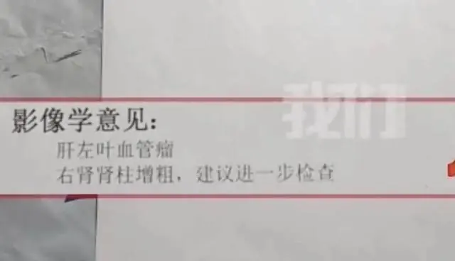 山东男子时隔8年CT报告反转，“良性肿瘤”变“肝癌”，8年等不到通知，耽误的岂止是一条命